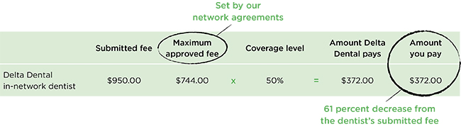 Delta Dental Price Chart